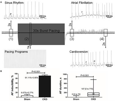 Chronic Kidney Disease Increases Atrial Fibrillation Inducibility: Involvement of Inflammation, Atrial Fibrosis, and Connexins